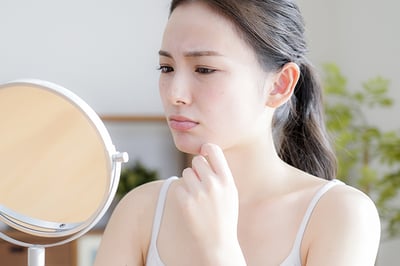 夏で受けたダメージ肌のニキビができる原因とは